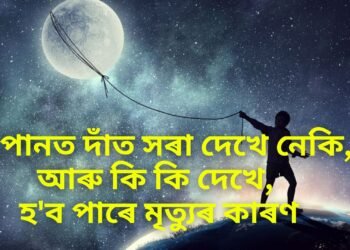 সপোনত দাঁত সৰা দেখে নেকি, আৰু কি কি দেখে, হ’ব পাৰে মৃত্যুৰ কাৰণ