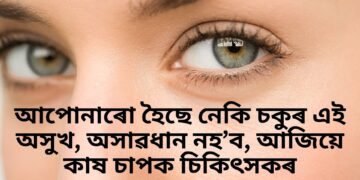 আপোনাৰো হৈছে নেকি চকুৰ এই অসুখ, অসাৱধান নহ’ব, আজিয়ে কাষ চাপক চিকিৎসকৰ