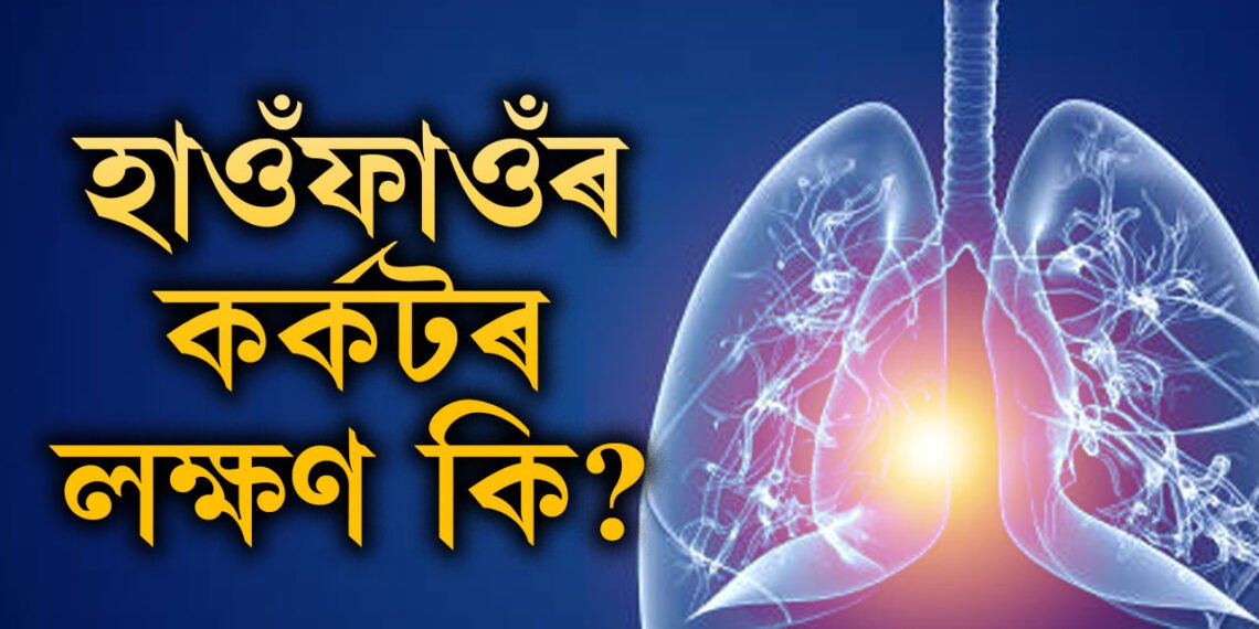 ধূম/পা/ন নকৰিলেও হ’ব পাৰে হাওঁফাওঁৰ কৰ্কট! কি কি উপসৰ্গ দেখিলে সতৰ্ক হ’ব?