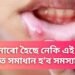 মুখৰ ভিতৰত হৈছে নেকি এনে ধৰণৰ ঘাঁ, মিনিটতে এই পদ্ধতিৰে ঠিক হ’ব সকলো