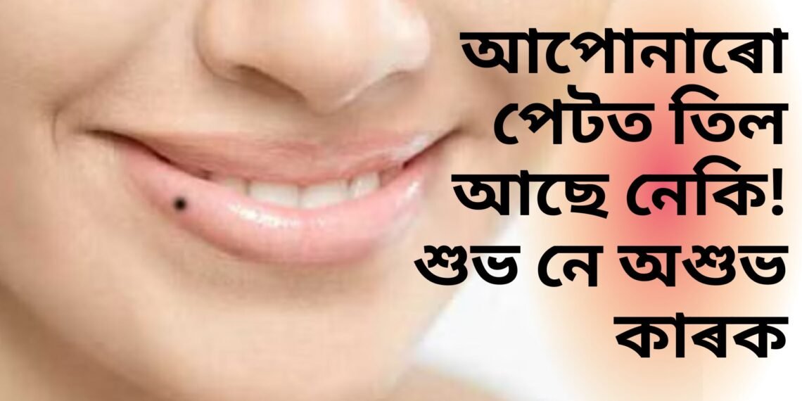 আপোনাৰো পেটত তিল আছে নেকি! শুভ নে অশুভ কাৰক, সবিশেষ পঢ়ক-