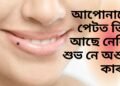 আপোনাৰো পেটত তিল আছে নেকি! শুভ নে অশুভ কাৰক, সবিশেষ পঢ়ক-
