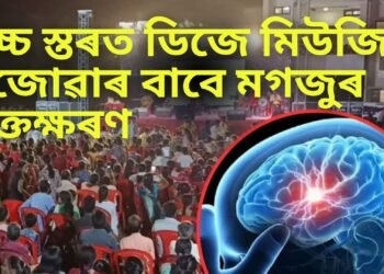 উচ্চ স্তৰত ডিজে মিউজিক বজোৱাৰ বাবে মগজুৰ ৰক্তক্ষৰণ এজন ব্যক্তিৰ, আচৰিত হৈ পৰিছে চিকিৎসক