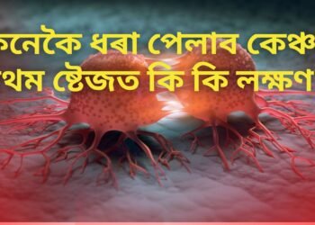 কেনেকৈ ধৰা পেলাব কেঞ্চাৰ, প্ৰথম ষ্টেজত কি কি লক্ষণ…