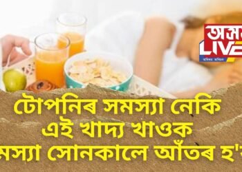 টোপনিৰ সমস্যা নেকি, এই খাদ্য খাওক, সমস্যা সোনকালে আঁতৰ হ’ব