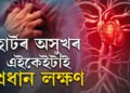 হাৰ্টৰ অসুখৰ এই লক্ষণসমূহ অৱহেলা কৰে অধিকাংশ মানুহে, সতৰ্কতা কি কি অৱলম্বন কৰিব?