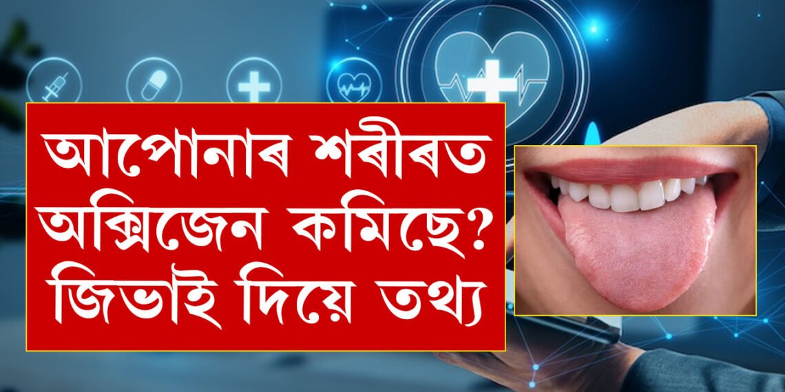 শৰীৰত অক্সিজেনৰ পৰিমান কমি যোৱা নাইতো? আপোনাৰ জিভাৰ ৰঙেই কৈ দিব সকলো