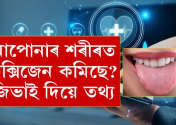 শৰীৰত অক্সিজেনৰ পৰিমান কমি যোৱা নাইতো? আপোনাৰ জিভাৰ ৰঙেই কৈ দিব সকলো