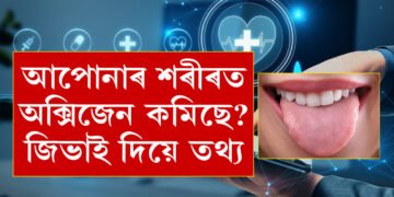 শৰীৰত অক্সিজেনৰ পৰিমান কমি যোৱা নাইতো? আপোনাৰ জিভাৰ ৰঙেই কৈ দিব সকলো