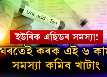 ইউৰিক এছিডৰ বাবে দৈনিক ঔষধ খাই আছে? এই ৬ অভ্যাস গঢ়ক, সমস্যা দূৰ হ’ব খাটাং