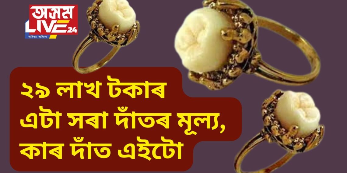 ২৯ লাখ টকাৰ এটা সৰা দাঁতৰ মূল্য, কাৰ দাঁত এইটো, যাৰ আজিয়ো বহু চাহিদা