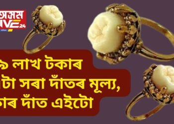 ২৯ লাখ টকাৰ এটা সৰা দাঁতৰ মূল্য, কাৰ দাঁত এইটো, যাৰ আজিয়ো বহু চাহিদা