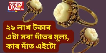 ২৯ লাখ টকাৰ এটা সৰা দাঁতৰ মূল্য, কাৰ দাঁত এইটো, যাৰ আজিয়ো বহু চাহিদা