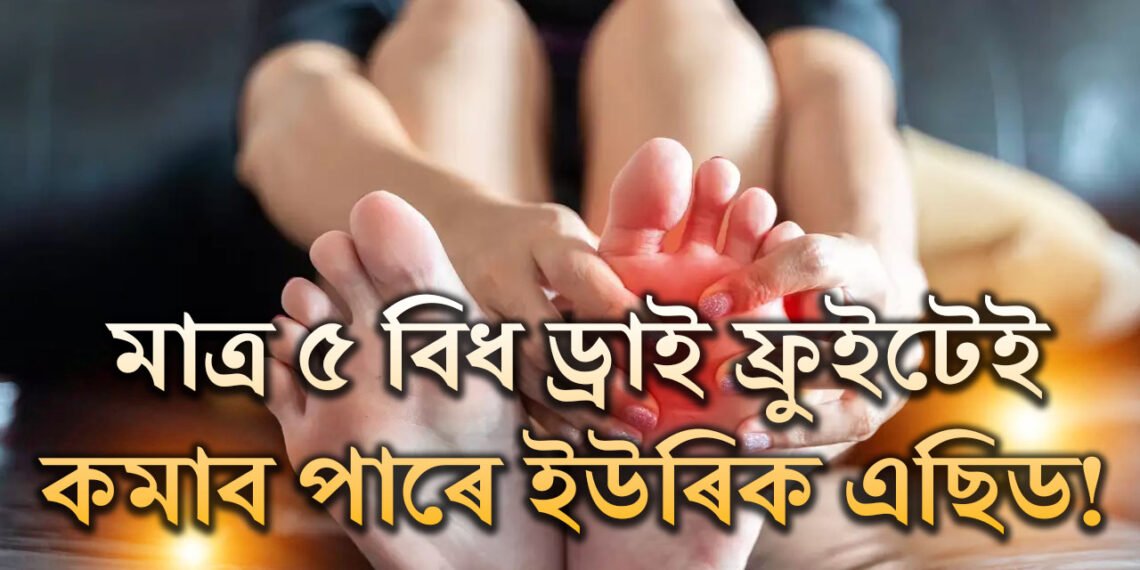 ইউৰিক এছিড বাঢ়িছে! এই ৫ ড্ৰাই ফ্ৰুইট নিয়মিত খালেই কমিব বিষ-যন্ত্ৰণা