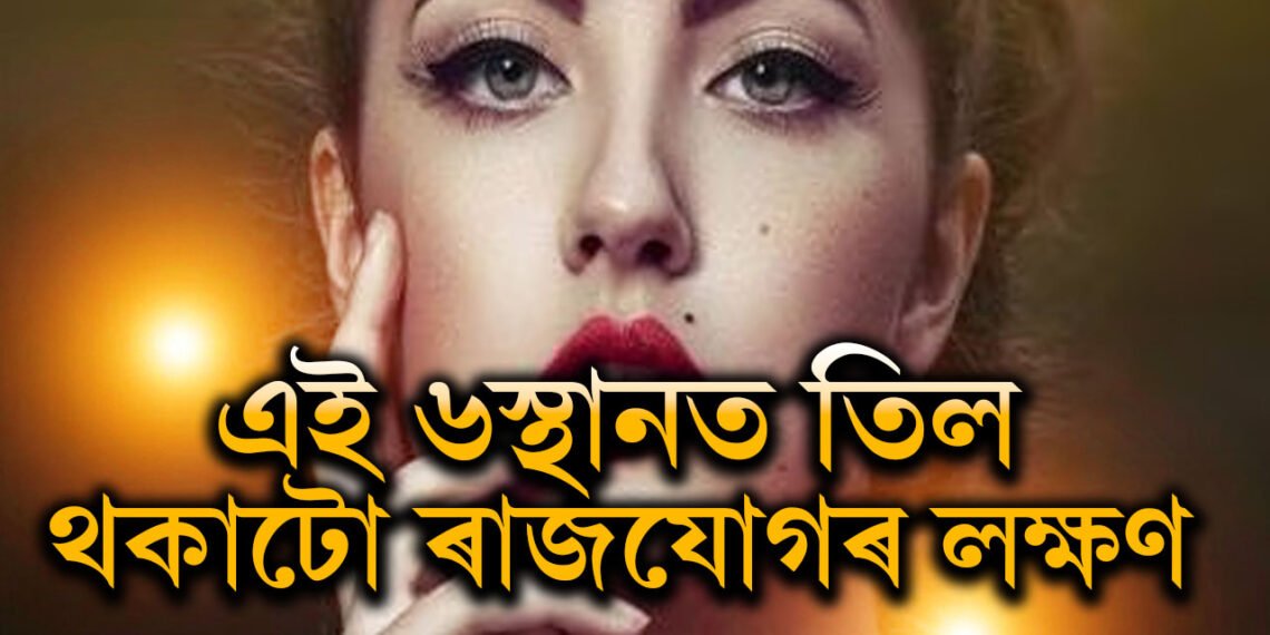 শৰীৰৰ এই ৬স্থানত তিল থকাটো ৰাজযোগৰ লক্ষণ, অৰ্থ, খ্যাতি, প্ৰতিপত্তিৰে শীৰ্ষত উপস্থিত হয় এইসকল জাতক