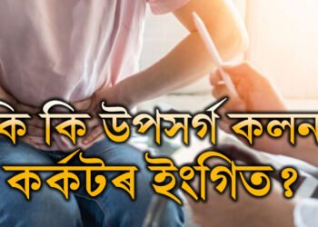 কমবয়সীয়াসকলৰ মাজত বাঢ়িছে কলনৰ কৰ্কট! কি কি উপসৰ্গ দেখিলে চিকিৎসকৰ পৰামৰ্শ ল’ব?