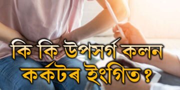 কমবয়সীয়াসকলৰ মাজত বাঢ়িছে কলনৰ কৰ্কট! কি কি উপসৰ্গ দেখিলে চিকিৎসকৰ পৰামৰ্শ ল’ব?