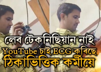 লেব টেকনিছিয়ান নাই, YouTube চাই হাস্পতালত ECG কৰিছে ঠিকাভিত্তিক কৰ্মীয়ে, চাওক ভিডিঅ’