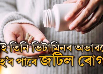 সাৱধান, এই ৩ ভিটামিনৰ অভাৱতেই হ’ব পাৰে জটিল ৰোগ