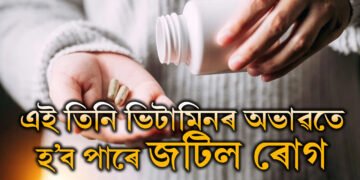সাৱধান, এই ৩ ভিটামিনৰ অভাৱতেই হ’ব পাৰে জটিল ৰোগ
