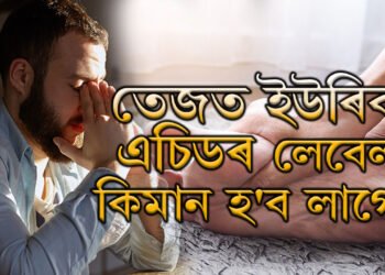 তেজত ইউৰিক এচিডৰ লেবেল কিমান হ’ব লাগে? ইউৰিক এছিড বাঢ়িলে কি ঘৰুৱা উপায়েৰে প্ৰতিকাৰ কৰিব?