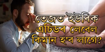 তেজত ইউৰিক এচিডৰ লেবেল কিমান হ’ব লাগে? ইউৰিক এছিড বাঢ়িলে কি ঘৰুৱা উপায়েৰে প্ৰতিকাৰ কৰিব?