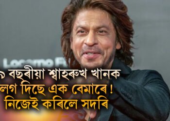 ৫৯ বছৰীয়া শ্বাহৰুখ খানক লগ দিছে এক বেমাৰে! নিজেই ৰাজহুৱাকৈ কৰিলে সদৰি