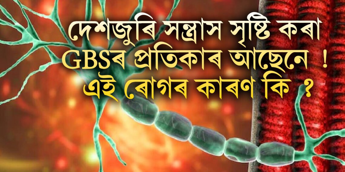 দেশজুৰি সন্ত্ৰাস সৃষ্টি কৰা GBSৰ প্ৰতিকাৰ আছেনে ! এই ৰোগৰ কাৰণ কি ?