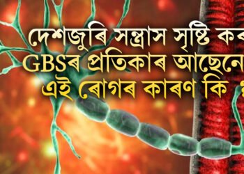 দেশজুৰি সন্ত্ৰাস সৃষ্টি কৰা GBSৰ প্ৰতিকাৰ আছেনে ! এই ৰোগৰ কাৰণ কি ?