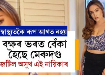 বক্ষৰ ভৰত চাপ পৰিছে মেৰুদণ্ডত! শাৰীৰিক যন্ত্ৰণাক লৈ মুখ খুলিছে জনপ্ৰিয় নায়িকাই