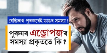 পুৰুষৰ এণ্ড্ৰোপজৰ সমস্যা প্ৰকৃততে কি? এই সমস্যাৰ পৰা হাত সাৰিব পাৰিনে?