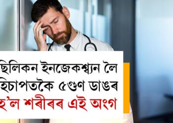 ছিলিকন ইনজেকশ্ব্যন দীৰ্ঘদিন ধৰি লৈছিল, পাঁচগুণ ডাঙৰ হৈ পৰিল শৰীৰৰ এই অংগ, চিকিৎসকে দিছে সতৰ্কবাৰ্তা