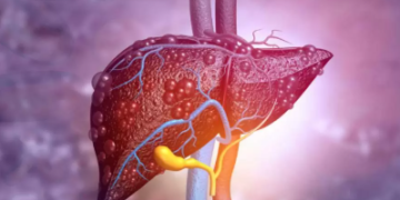 ভাৱিবই নোৱাৰিব, এইসমূহেই লিভাৰ ছিৰোচিছৰ সংকেত, আগতেই সচেতন নহ’লে ভয়ংকৰ বিপদ হ’ব পাৰে আপোনাৰো