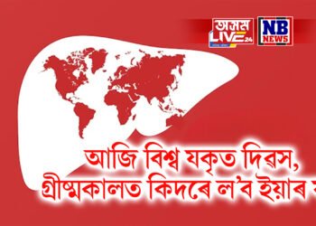 আজি বিশ্ব যকৃত দিৱস, গ্ৰীষ্মকালত কিদৰে ল’ব ইয়াৰ যত্ন, আজিয়ে ত্যাগ কৰক এই অভ্যাস