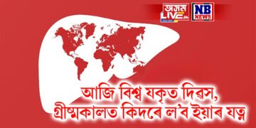 আজি বিশ্ব যকৃত দিৱস, গ্ৰীষ্মকালত কিদৰে ল’ব ইয়াৰ যত্ন, আজিয়ে ত্যাগ কৰক এই অভ্যাস