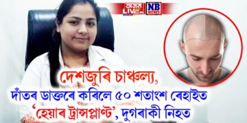 দেশজুৰি চাঞ্চল্য, দাঁতৰ ডাক্তৰে কৰিলে ৫০ শতাংশ ৰেহাইত ‘হেয়াৰ ট্ৰান্সপ্লাণ্ট’, দুগৰাকী নিহত