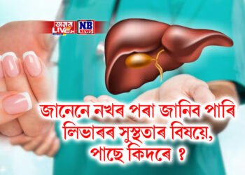 জানেনে নখৰ পৰা জানিব পাৰি লিভাৰৰ সুস্থতাৰ বিষয়ে, পাছে কিদৰে ?