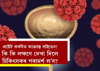 প্ৰষ্টেট কৰ্কটত আক্ৰান্ত বাইডেন! জানক প্ৰস্ৰাৱৰ ধাৰা দুৰ্বল হোৱাৰ এয়া লক্ষণ নেকি? কেনেকৈ সময়মতে এই ৰোগ সম্পৰ্কে জানিব পাৰিব?