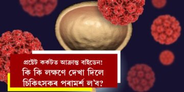 প্ৰষ্টেট কৰ্কটত আক্ৰান্ত বাইডেন! জানক প্ৰস্ৰাৱৰ ধাৰা দুৰ্বল হোৱাৰ এয়া লক্ষণ নেকি? কেনেকৈ সময়মতে এই ৰোগ সম্পৰ্কে জানিব পাৰিব?