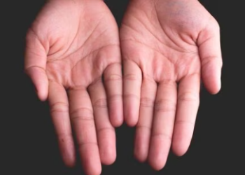 হাতৰ আঙুলিয়েই কৈ দিয়ে আপুনি অৰ্থবান হোৱাৰ সম্ভাৱনা আছেনে? মধ্যমাৰ এই লক্ষণতেই বুজা যায় অৰ্থভাগ্য