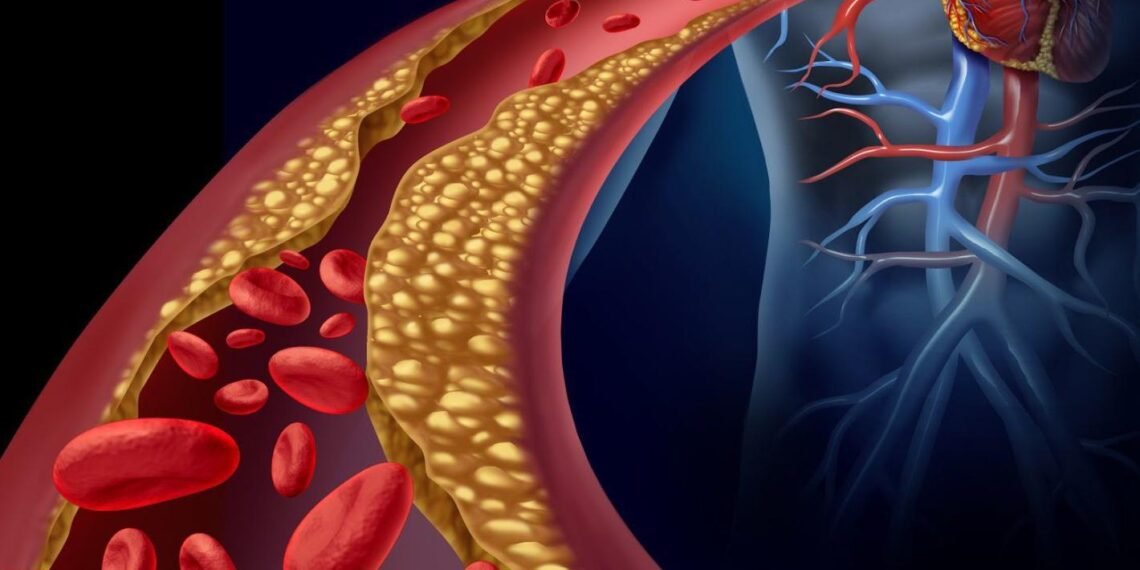 শৰীৰত নিঃশব্দে বাঢ়িছে কলষ্টেৰল? ৫ অভ্যাস সলনি নকৰিলে আহিব চৰম বিপদ