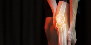 হাড়ৰ কৰ্কটৰ লক্ষণ কেনে হয়? এই ৫ সংকেত অৱহেলা কৰিলেই ভয়ংকৰ বিপদ