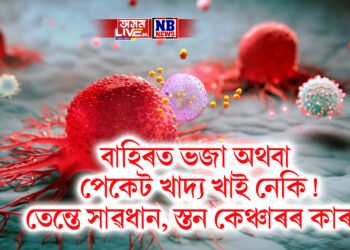 বাহিৰত ভজা অথবা পেকেট খাদ্য খাই নেকি! তেন্তে সাৱধান, স্তন কেঞ্চাৰৰ কাৰক