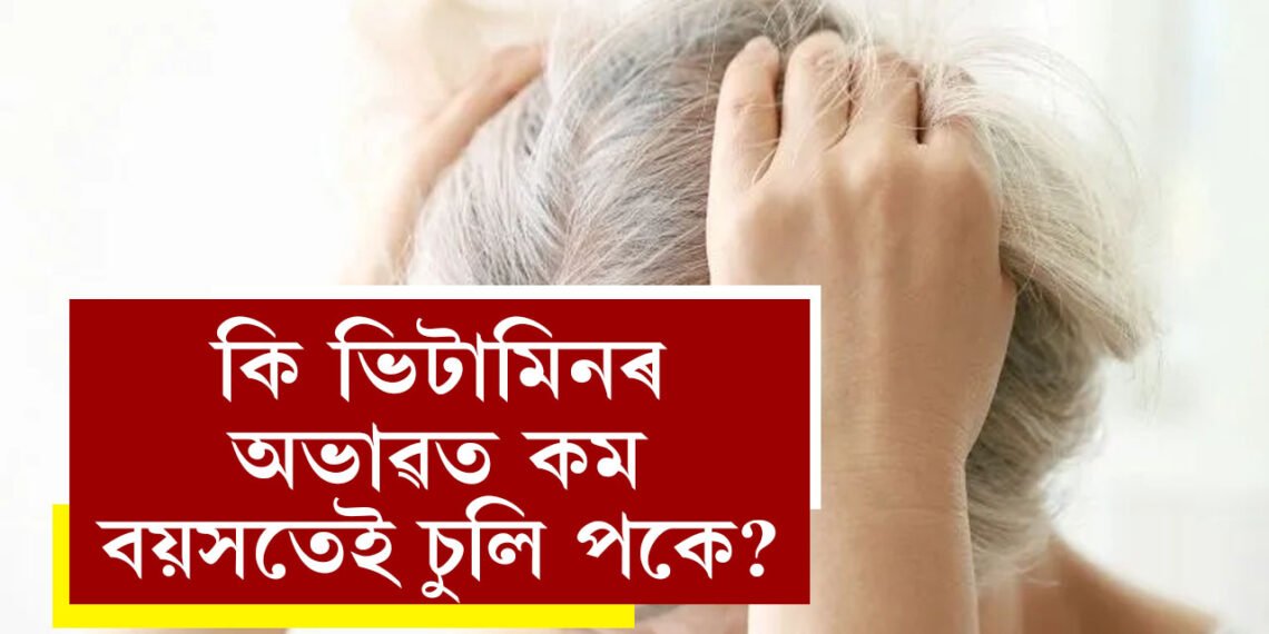 কি ভিটামিনৰ অভাৱত কম বয়সতেই চুলি পকে? দৈনিক খাদ্যভ্যাসত কি কি সালসলনি আনিব?