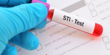 গ্ৰাস কৰিব বন্ধ্যাত্বই, হেৰুৱাব পুৰুষত্বও, ভয়ংকৰ সংক্ৰামক যৌ* ৰোগ গণৰিয়াৰ উপসৰ্গ কি কি? জানক সবিশেষ