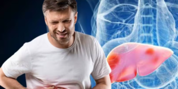 ফেটি লিভাৰে ক্ষতি কৰে শৰীৰৰ এই ৪ অংগৰ, কি ৭ বিধ খাদ্য এই ৰোগৰ ৰক্ষাকবচ?