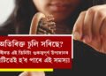 অতিৰিক্ত চুলি সৰিছে? সাৱধান হওক, শৰীৰত এই তিনিটা গুৰুত্বপূৰ্ণ উপাদানৰ ঘাটিতেই হ’ব পাৰে এই সমস্যা