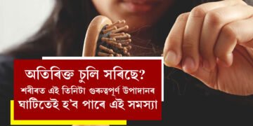 অতিৰিক্ত চুলি সৰিছে? সাৱধান হওক, শৰীৰত এই তিনিটা গুৰুত্বপূৰ্ণ উপাদানৰ ঘাটিতেই হ’ব পাৰে এই সমস্যা