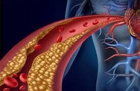 খৰতকীয়াকৈ গলিব ৰক্তনলীত জমা হোৱা পুৰণি কলষ্টেৰল, নিশাৰ বিছনালৈ যোৱাৰ পূৰ্বে খাওক এই খাদ্য