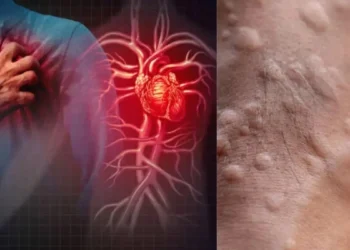 ছালত ফুটি উঠে হাৰ্ট এটেকৰ লক্ষণ! কি কি উপসৰ্গই দেখা দিলে বুজিব হৃদৰোগৰ আক্ৰান্ত হোৱাৰ সম্ভাৱনা আছে?